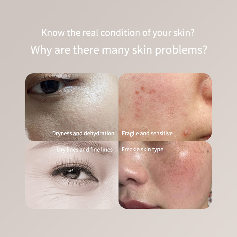 Skincare Only You - قلم اختبار الجلد المحمول - للوجه