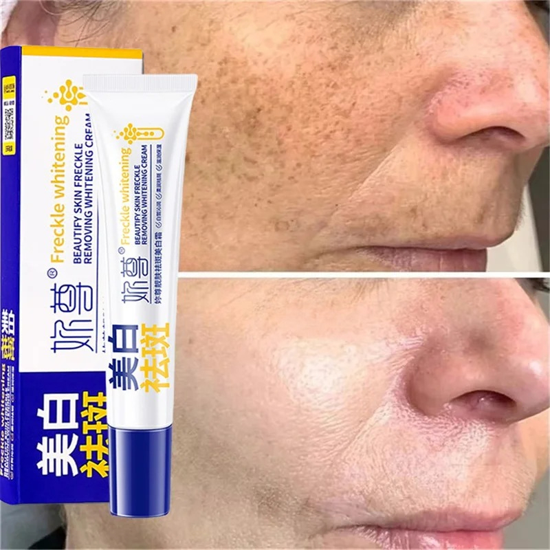 كريم تبييض قوي لإزالة البقع يف - مراجعة Skincare Whitening وسعره