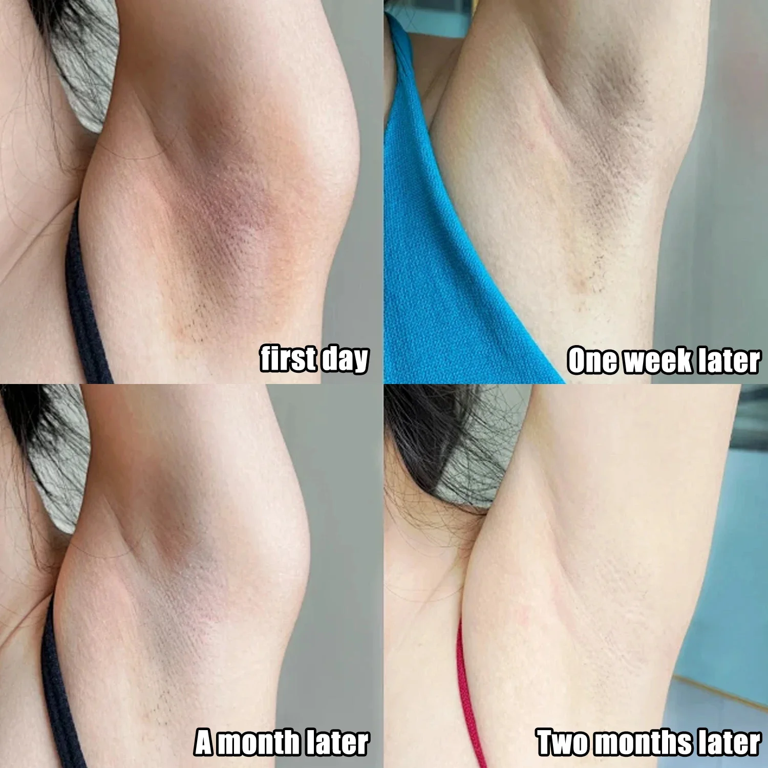 كريم تفتيح منطقة تحت الإبط بال - مراجعة Skincare Whitening وسعره