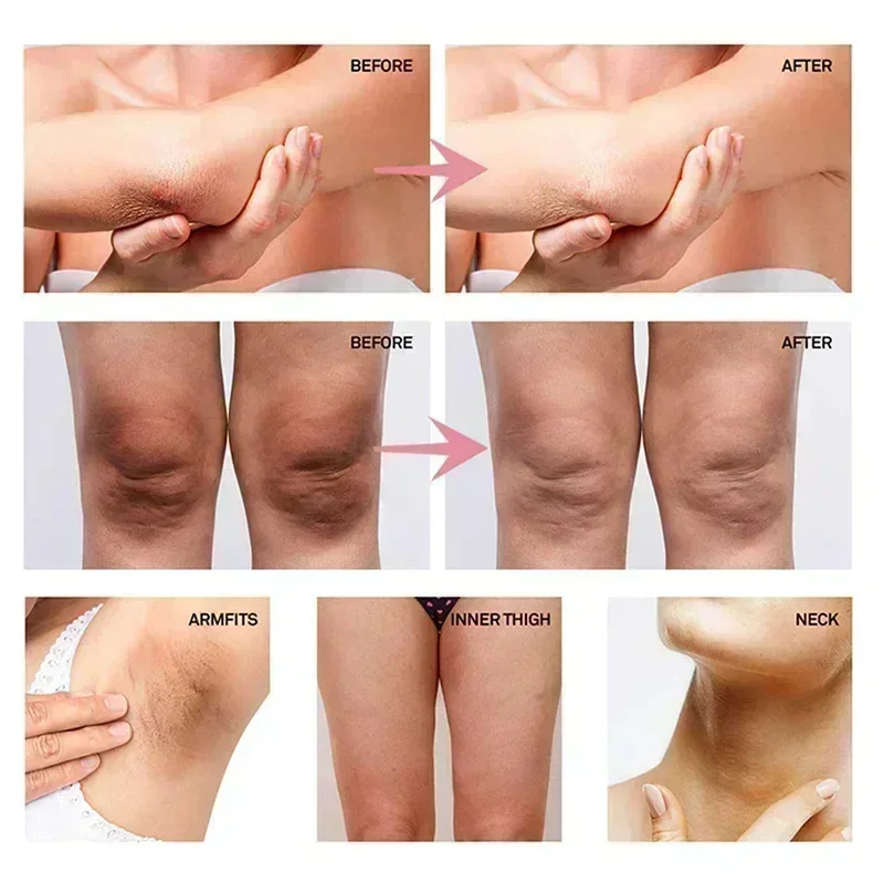 كريم تفتيح منطقة تحت الإبط بال - مراجعة Skincare Whitening وسعره