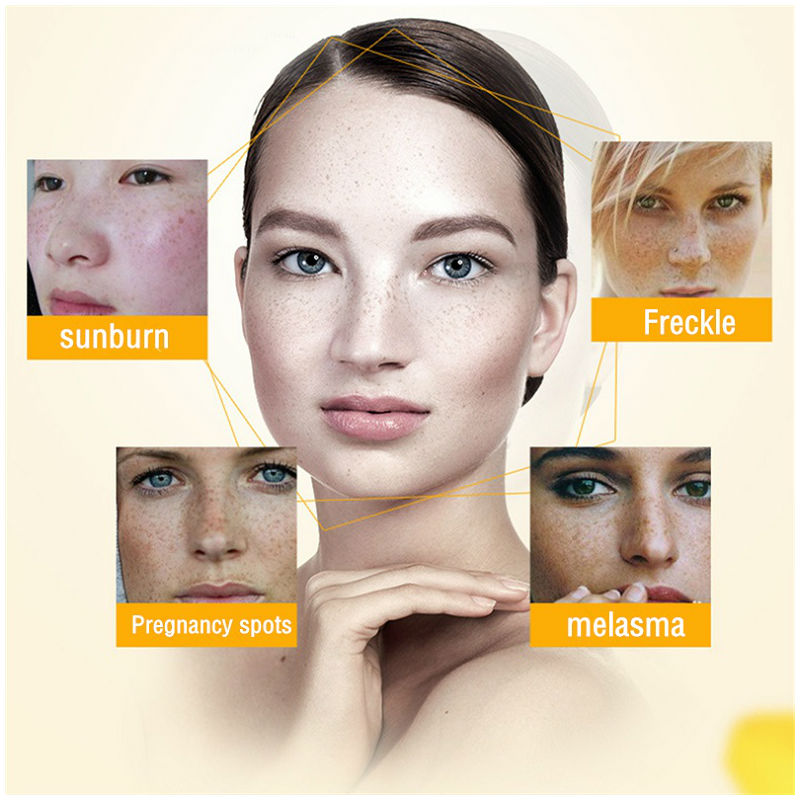Dimollaure كريم تبييض النمش تر - مراجعة Skincare Korea وسعره