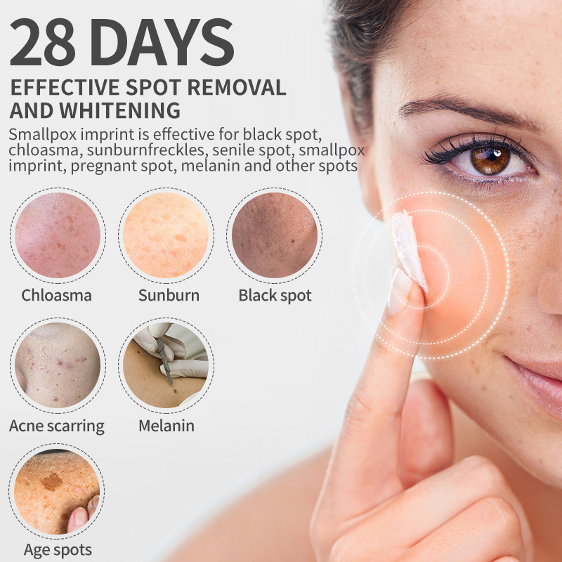 Dimollaure كريم تبييض النمش تر - مراجعة Skincare Korea وسعره
