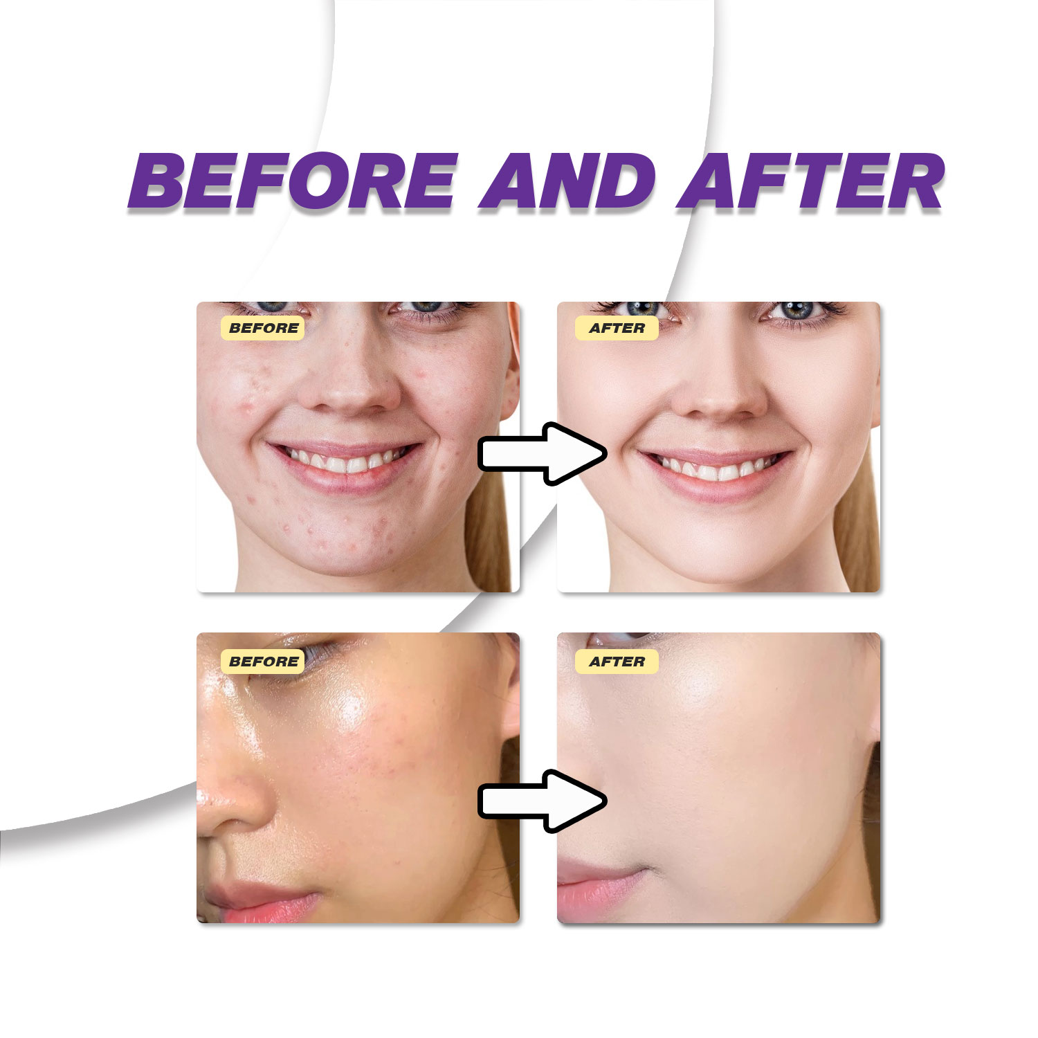 كريم حمض الأزيليك الخفيف لتحسي - مراجعة Skincare Skintific وسعره