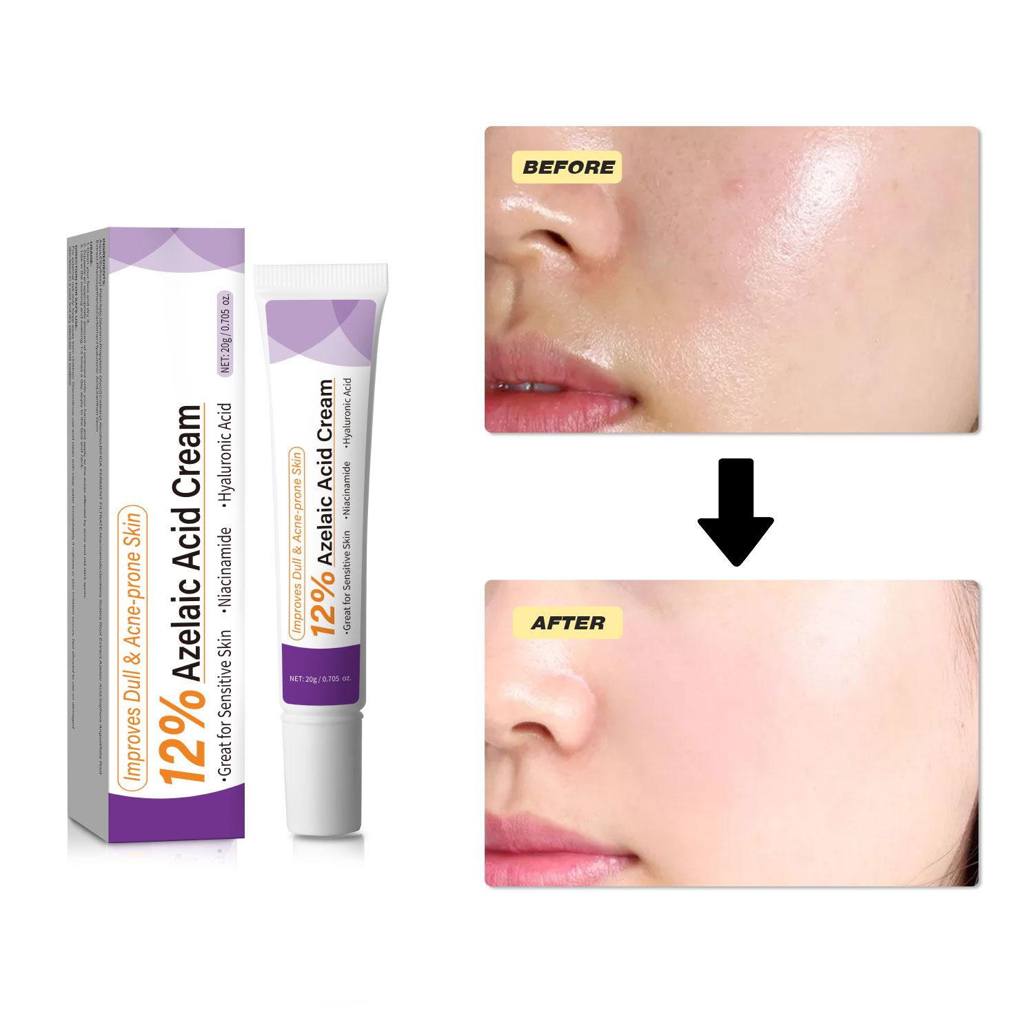 كريم حمض الأزيليك الخفيف لتحسي - مراجعة Skincare Skintific وسعره