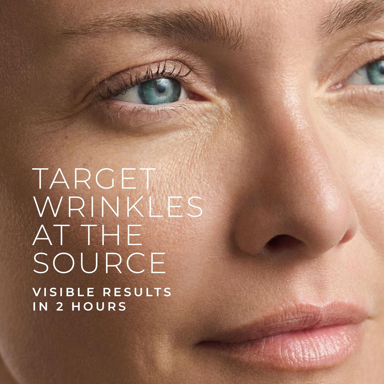لصقات العين بالإبر الدقيقة مع  - مراجعة Skincare You وسعره